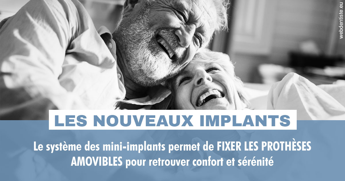 https://dr-gruson-xavier.chirurgiens-dentistes.fr/Les nouveaux implants 2