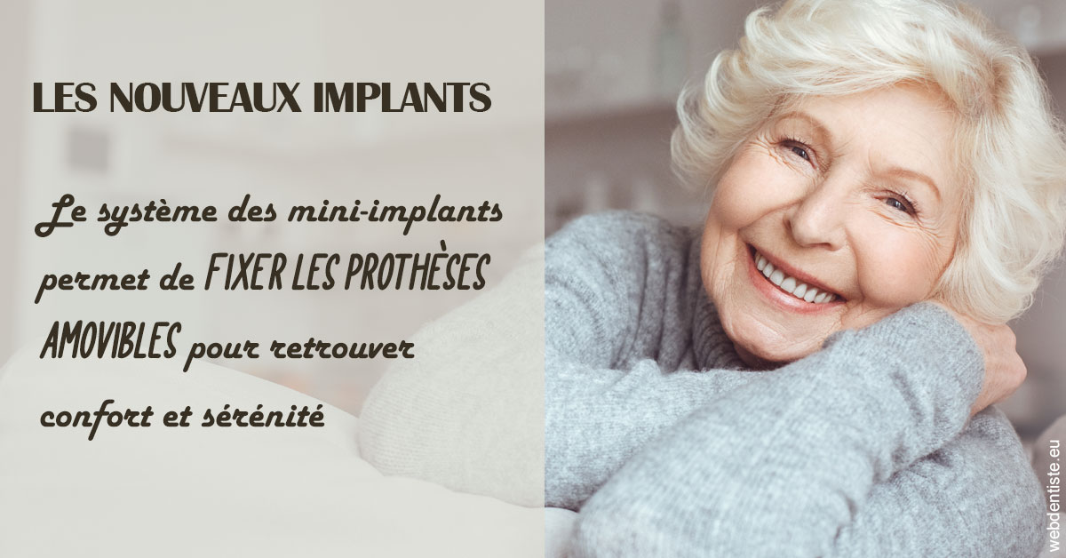 https://dr-gruson-xavier.chirurgiens-dentistes.fr/Les nouveaux implants 1