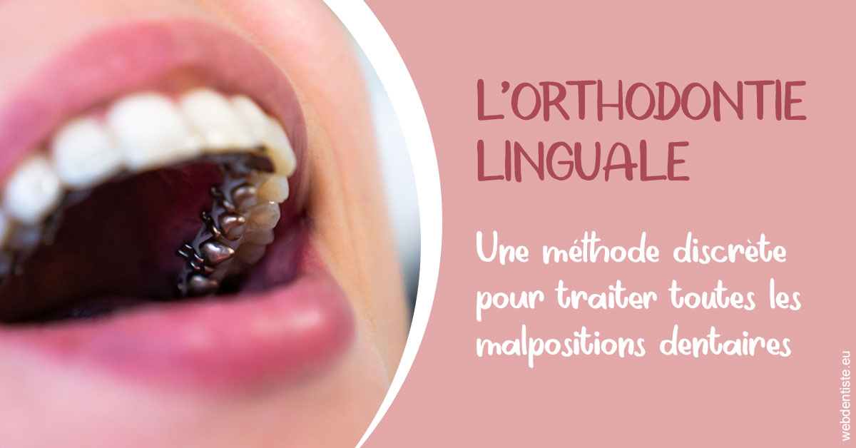 https://dr-gruson-xavier.chirurgiens-dentistes.fr/L'orthodontie linguale 2