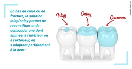 https://dr-gruson-xavier.chirurgiens-dentistes.fr/L'INLAY ou l'ONLAY