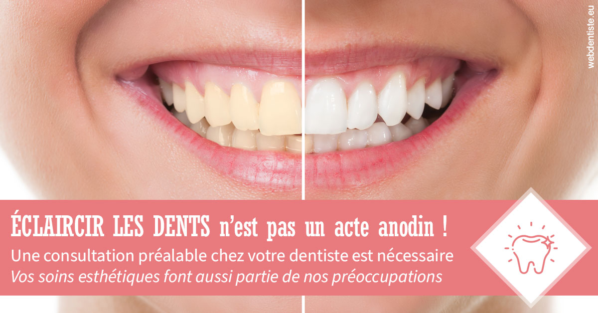 https://dr-gruson-xavier.chirurgiens-dentistes.fr/Eclaircir les dents 1