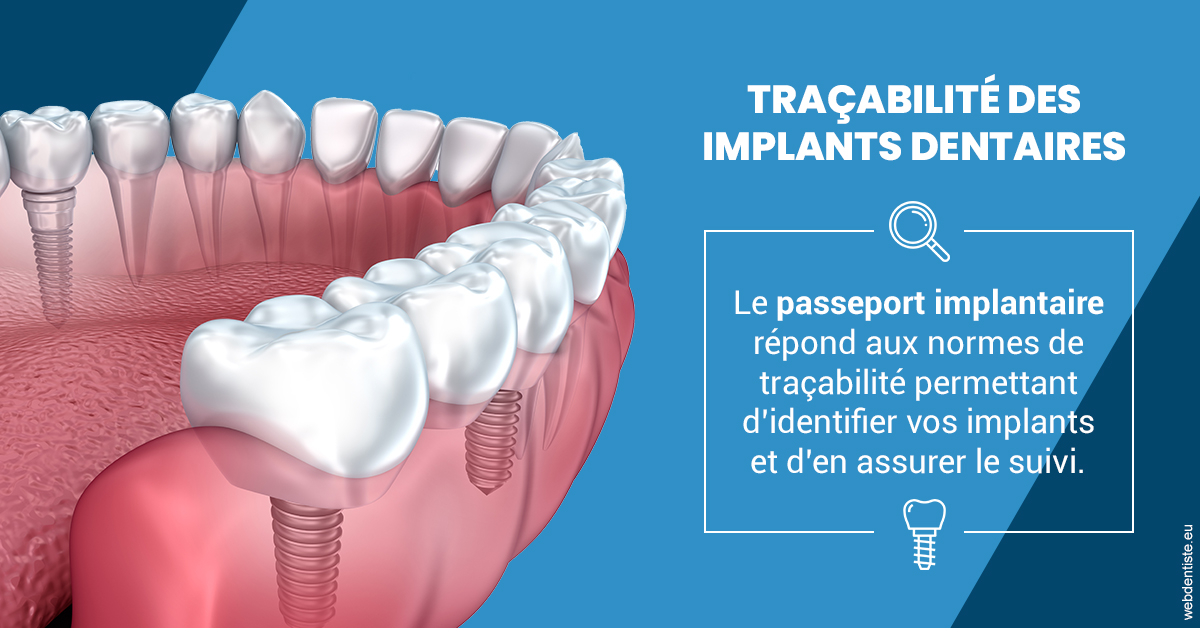 https://dr-gruson-xavier.chirurgiens-dentistes.fr/T2 2023 - Traçabilité des implants 1