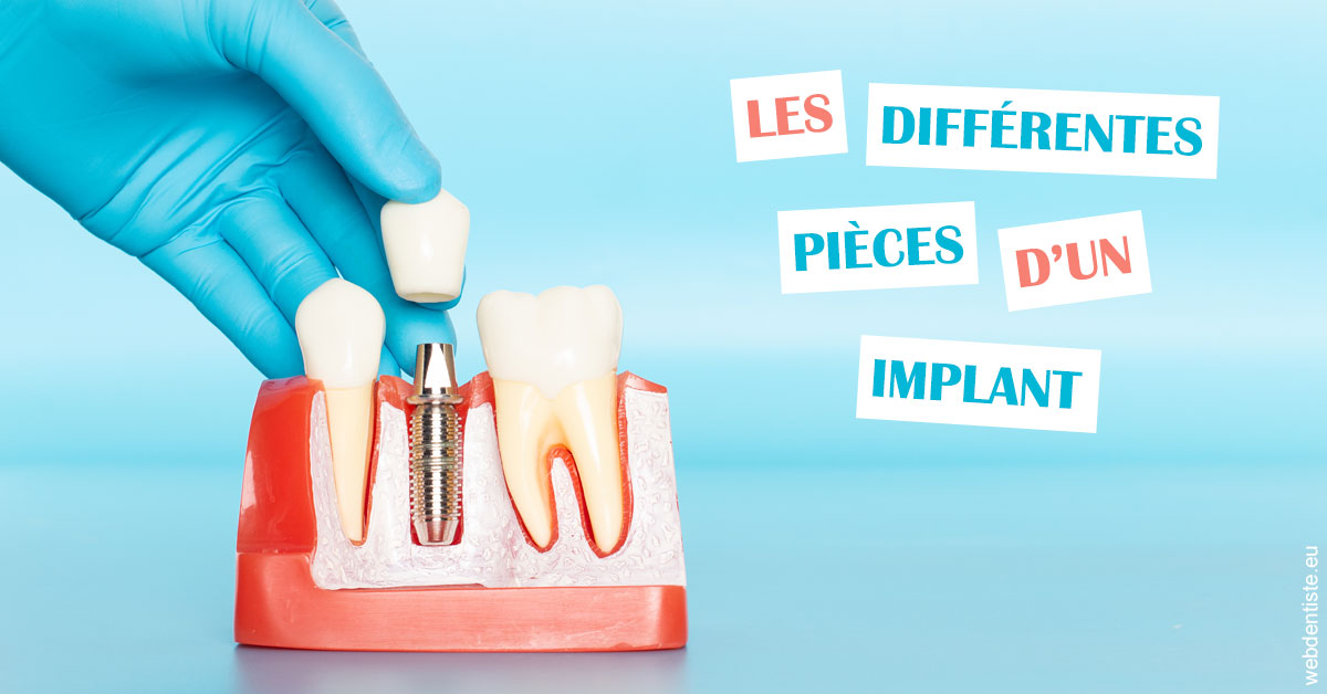 https://dr-gruson-xavier.chirurgiens-dentistes.fr/Les différentes pièces d’un implant 2