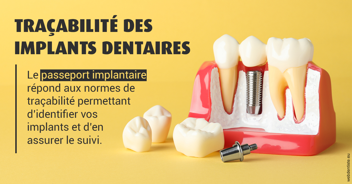 https://dr-gruson-xavier.chirurgiens-dentistes.fr/T2 2023 - Traçabilité des implants 2
