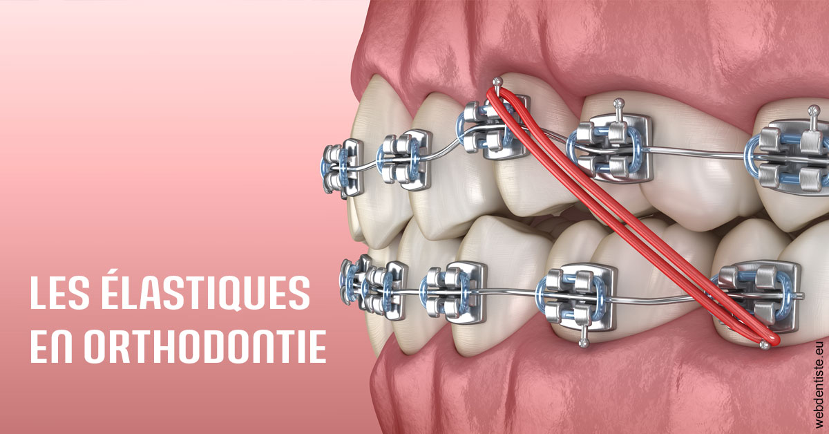 https://dr-gruson-xavier.chirurgiens-dentistes.fr/Elastiques orthodontie 2