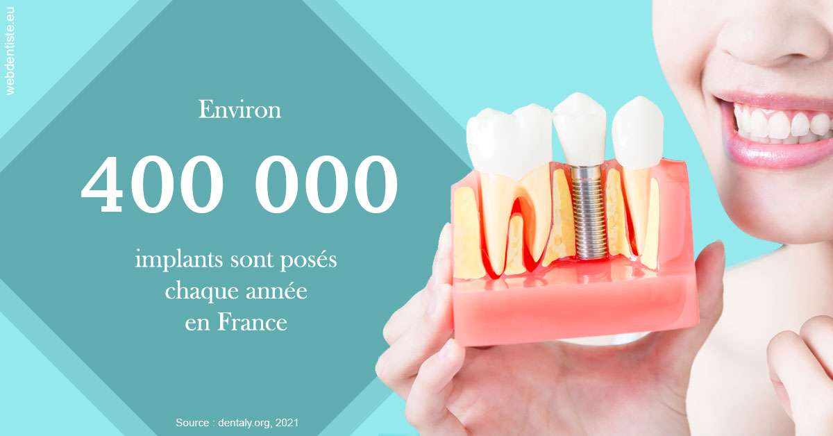 https://dr-gruson-xavier.chirurgiens-dentistes.fr/Pose d'implants en France 2